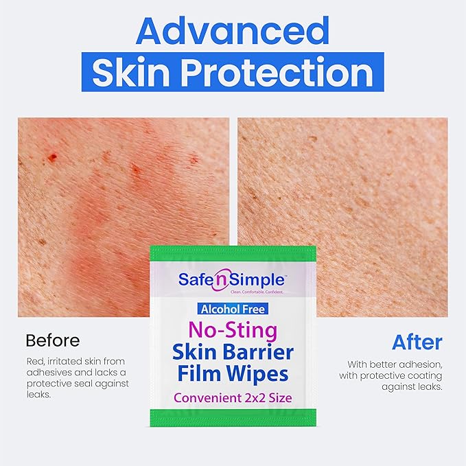 Safe n' Simple No Sting Skin Prep Wipes - 75 Individual 2" x 2" Ostomy Barrier Film Wipes - Skin Prep Protective Wipes - Bandage Medical for Skin