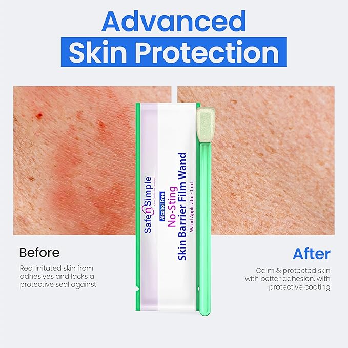 Safe n' Simple Skin Barrier Wand - 25 Individually Packed Wands - Sting Free Applicator - Sterile Swab for Ostomy - No Sting Alcohol Free Skin Barrier Film