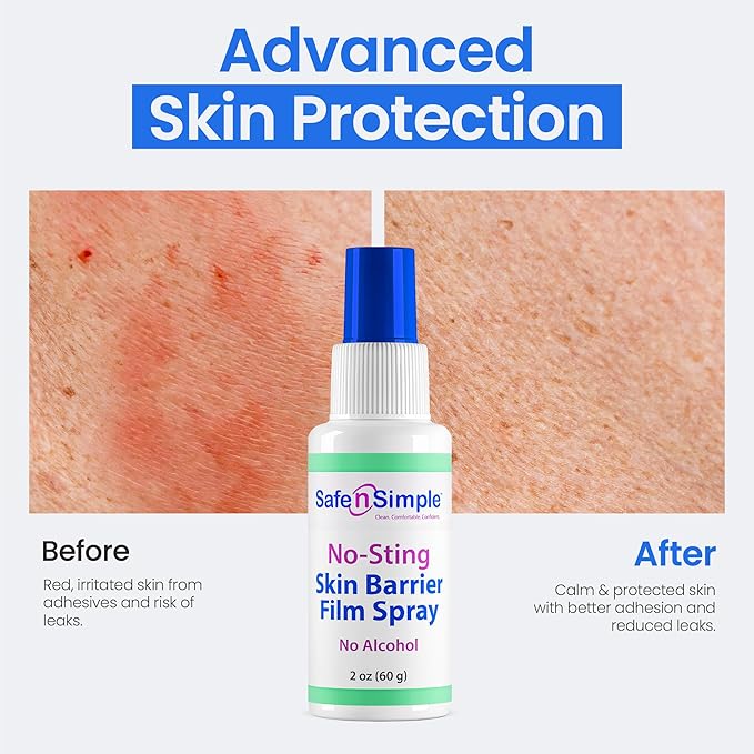 Safe n' Simple No Sting Barrier Film Spray - 2 Oz - Odor-Free Pre Tape Solution - No-Alcohol Skin Prep - Adult Adhesive Spray for Skin Protectant